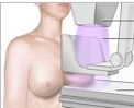 Mammogram.jpg