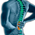 Person with Back Pain